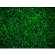 人椎间盘纤维环细胞（HAFC）- 纤维连接蛋白免疫染色，200x。
