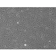 人直肠微血管内皮细胞（HRecMEC）- 相差显微镜图像，100×