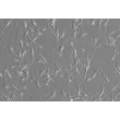 人类施旺细胞 (HSC) - 浮雕对比，200倍。