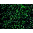 小脑星形胶质细胞 (HA-c) - GFAP 免疫染色，100x。
