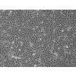 人类星形胶质细胞（HA） - 相差显微镜, 100倍。