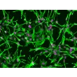人类星形胶质细胞（HA） - GFAP免疫染色，200倍。