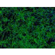 人类毛发外根鞘细胞 (HHORSC) - 纤维连接蛋白免疫染色，100x。