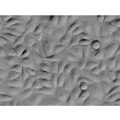 人类毛囊角质形成细胞（HHFK）- 立体对比，400倍显微镜观察