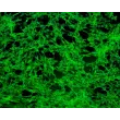 人类牙龈成纤维细胞（HGF） - 免疫染色显示纤维连接蛋白，200倍。