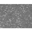 人类直肠平滑肌细胞（HRSMC）- 相差显微镜，100倍放大。