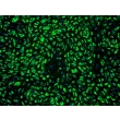 人类真皮微血管内皮细胞-成人 (HDMEC-a) - vWF 免疫染色，100x。