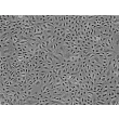 人类真皮微血管内皮细胞 (HDMEC) - 相差显微镜成像，100x。
