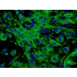 人类真皮微血管内皮细胞 (HDMEC) - vWF 免疫染色，400x。