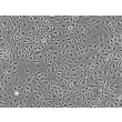 
人类真皮淋巴内皮细胞 (HDLEC) - 相差显微镜成像，100x。