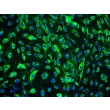 人类真皮淋巴内皮细胞 (HDLEC) - vWF 免疫染色，200x。