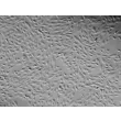 人类肺动脉内皮细胞（HPAEC） - 高反差，100倍。