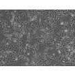 人类肾小管系膜细胞 (HRMC) - 相差显微镜，100倍。