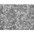 人类表皮角质形成细胞-成人 (HEK-a) - 相差显微镜，100x。