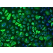 人类表皮角质形成细胞-成人 (HEK-a) - CK-18 免疫染色，100x。