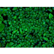 人类表皮角质形成细胞-新生儿 (HEK-n) - CK-18 免疫染色，200x。