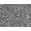 
人类表皮角质形成细胞-胎儿 (HEK-f) - 相差显微镜，100x。