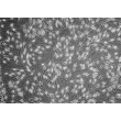 人类表皮黑素细胞-黑色 (HEM-d) - 相差显微镜，100倍