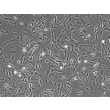 人类视网膜星形胶质细胞（HRA）- 相差显微镜，100倍放大。