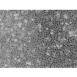 人精囊上皮细胞（HSVEpiC）- 相差显微镜，100倍