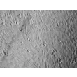 人精囊成纤维细胞（HSVF）- 反差显微镜，200×