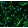 人类肝星状细胞（HHSteC） - α-平滑肌肌动蛋白免疫染色，400倍放大。