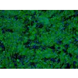 人肝细胞 (HH) - 针对细胞角蛋白-18 (CK-18) 的免疫染色，100倍。