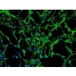 人类股骨成骨细胞（HO-f）- 免疫染色标记纤维连接蛋白，200倍。
