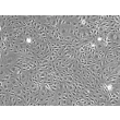 人胰腺微血管内皮细胞（HPaMEC）- 相差显微成像，100×