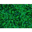 人胰腺微血管内皮细胞（HPaMEC）- vWF 免疫染色（Sigma-Aldrich，产品编号 #F3520），200×
