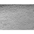 人类脉络丛上皮细胞（HCPEpiC） - 立体对比，100倍。