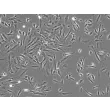 人类脉络丛上皮细胞（HCPEpiC） - 相位对比，100倍。