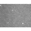 人骨髓间充质干细胞（HMSC-bm）—— 相差显微镜，100×