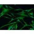 兔星形胶质细胞（RabA）— GFAP 免疫染色，200×倍率。
