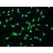 兔皮肤成纤维细胞（RabDF）— FN（纤维连接蛋白）免疫染色，200×倍率。