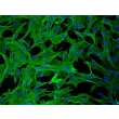 兔肝星状细胞（RabHSteC）— α-平滑肌肌动蛋白（α-SMA）免疫染色，200×倍率。