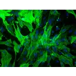 兔肾系膜细胞（RabRMC）— α-SMA（α-平滑肌肌动蛋白）免疫染色，200×倍率。
