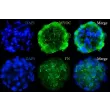 SP3D-HTMCS免疫染色分析显示小梁网细胞标志物Myocilin（MYOC）以及细胞外基质标志物纤维连接蛋白（Fibronectin，FN）的表达