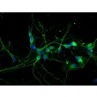 大鼠中脑神经元（RN-mb）——β-tubulin III 免疫染色，400×。