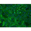 大鼠主动脉平滑肌细胞（RASMC）——α-SMA免疫染色，200×
