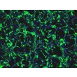 大鼠星形胶质细胞（RA）— GFAP 免疫染色图像，200×
