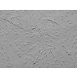 青少年心室心脏成纤维细胞（HCF-av）- 浮雕对比（Relief contrast），100 倍。
