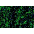 青少年心室心脏成纤维细胞（HCF-av）- 纤维连接蛋白免疫染色，100 倍。

