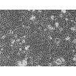 成人人支气管上皮细胞（HBEpiC-a）- 相差显微镜，100×。