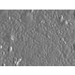 成人人支气管上皮细胞（HBEpiC-a）- 浮雕相差显微镜，200×。