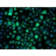 成人人支气管上皮细胞（HBEpiC-a）- 细胞角蛋白 18（CK-18）免疫染色，200×。
