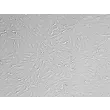 成年大鼠星形胶质细胞 —— 浮雕相差显微镜图像，200×
