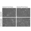 耐热型bFGF的生物活性优于天然bFGF。将天然bFGF（左）和rhbFGFTS（右）溶液分别在4°C（未受热应激）或37°C（热应激）条件下储存72小时后，用于处理HUVEC细胞。