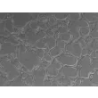 Cells day 1 of assay, 100x (day 1 cond1-10x)
