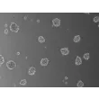 Days 3; 3D Human Blood Brain Barrier Spheroids (At 100X magnification). 